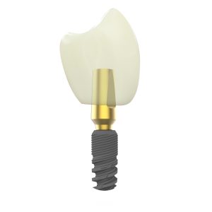 dental implants