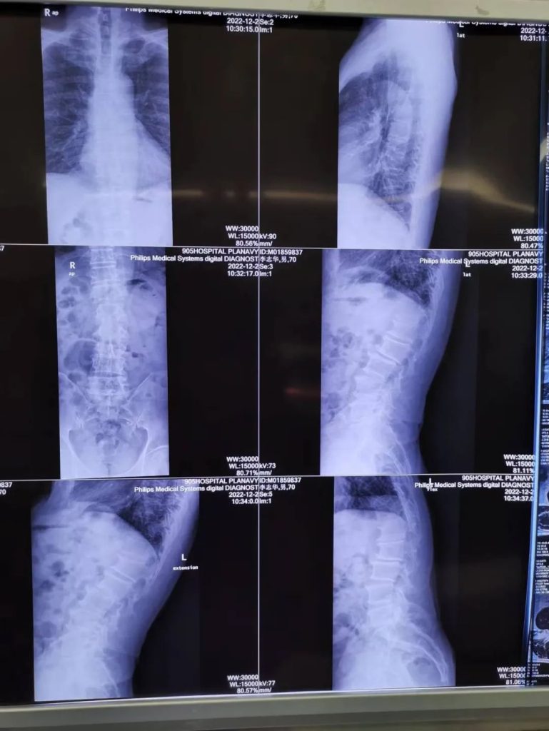 Pre-operative Examination of Case 2