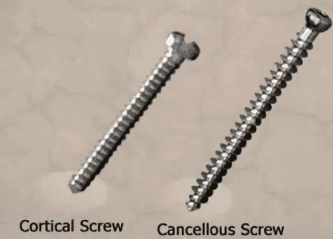 Screw cap comparison