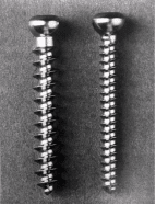 orthopedic plates and screws
