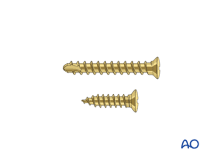 orthopedic plates and screws