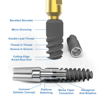 dental implants