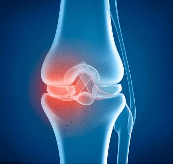 meniscal injury